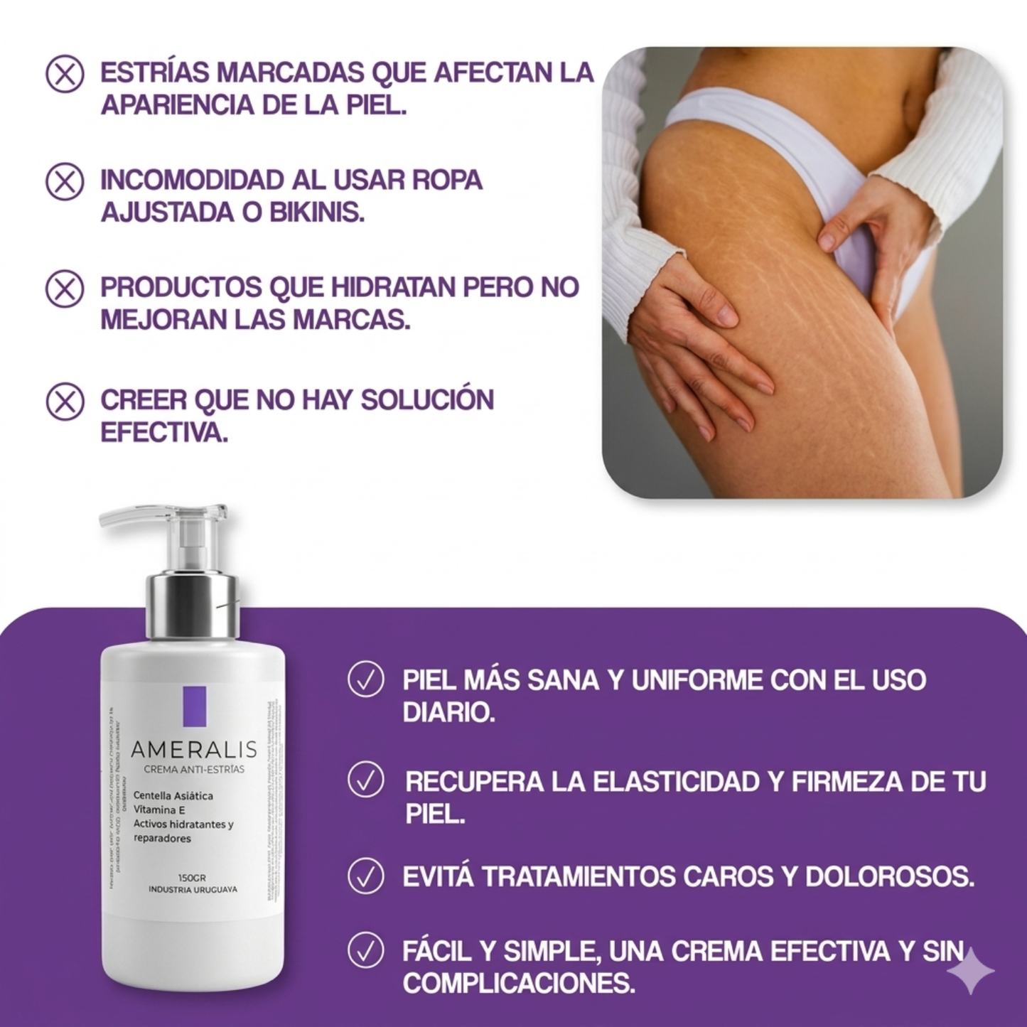 Crema anti-estrías Regeneradora