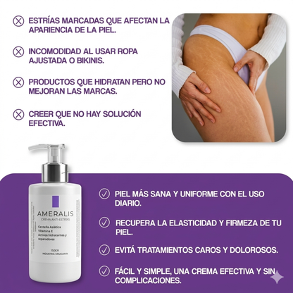 Crema anti-estrías Regeneradora