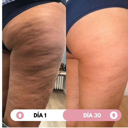 Crema reafirmante anticelulítica Termoactiva