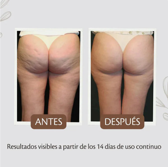 Crema Reafirmante Anticelulítica Termoactiva