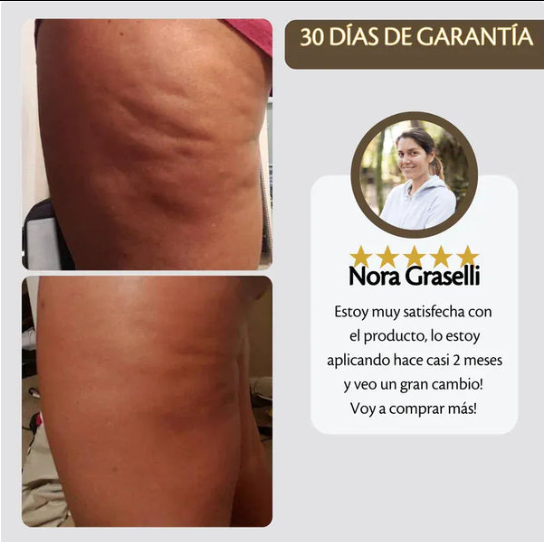 Crema Reafirmante Anticelulítica Termoactiva